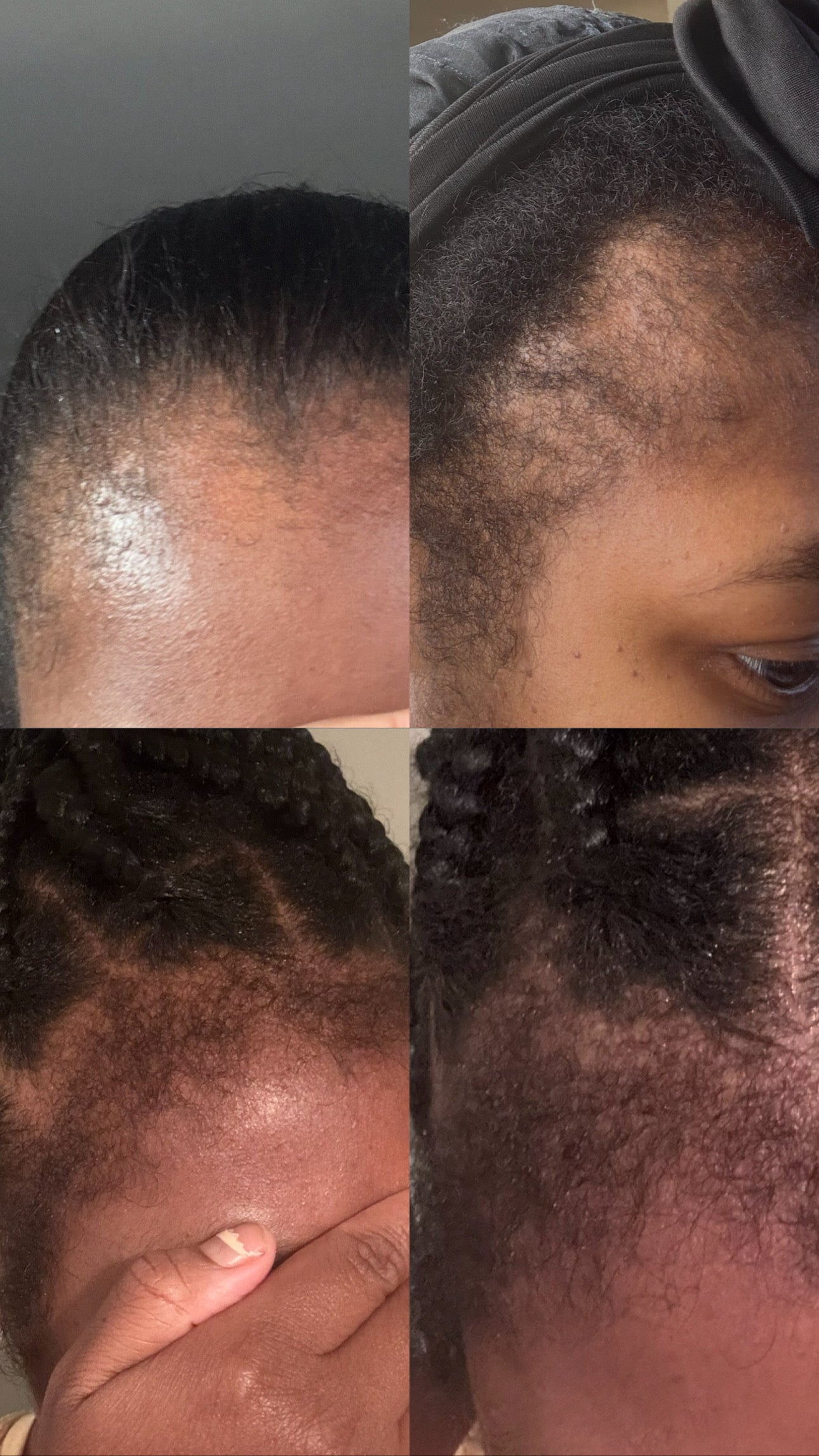 Revitalizing Hair Growth Oil