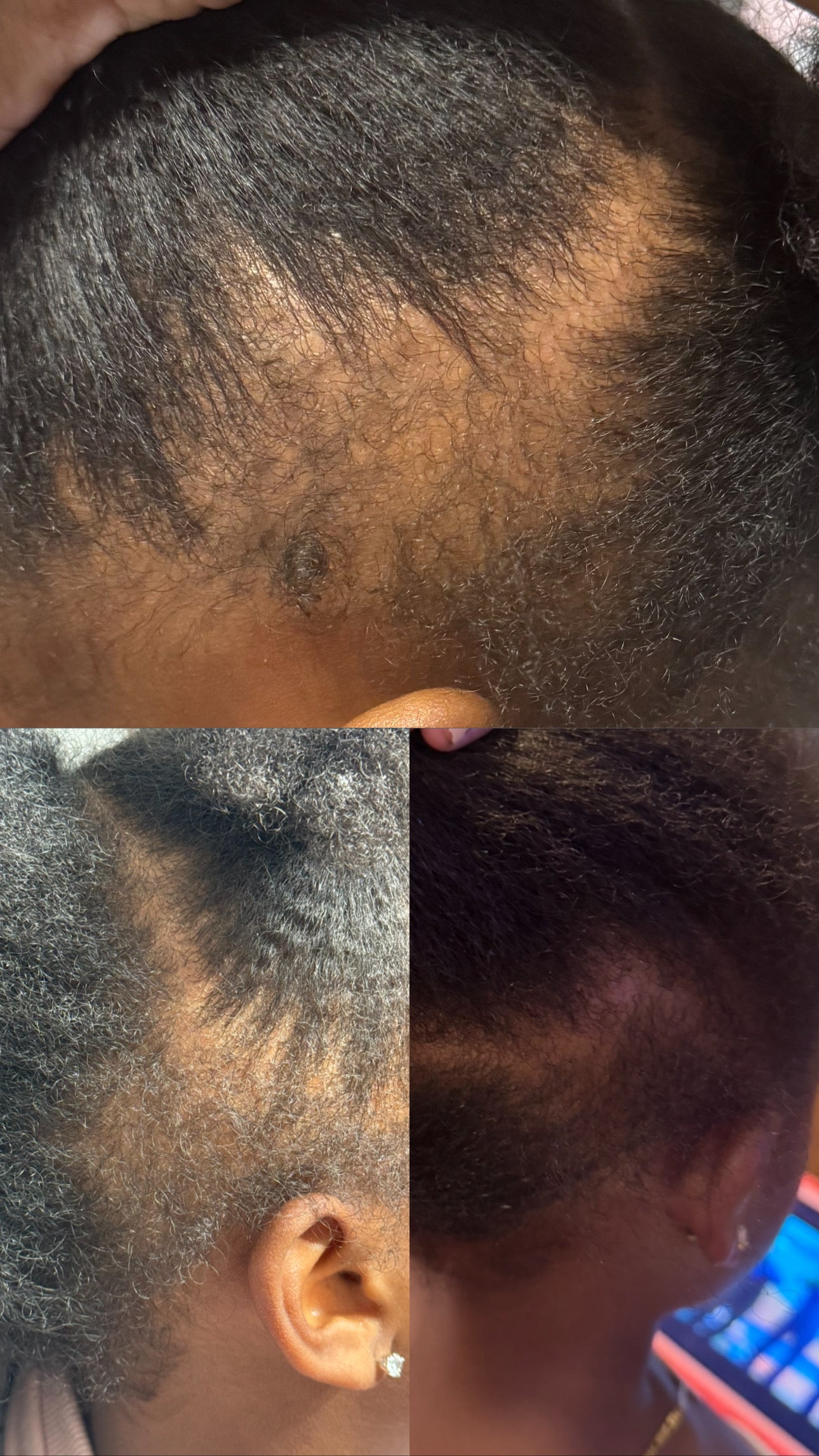 Revitalizing Hair Growth Oil